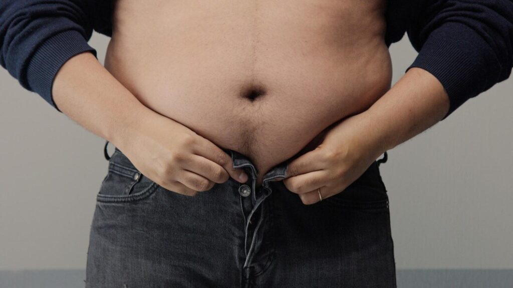 Gastric bypass surgery-cost- in India