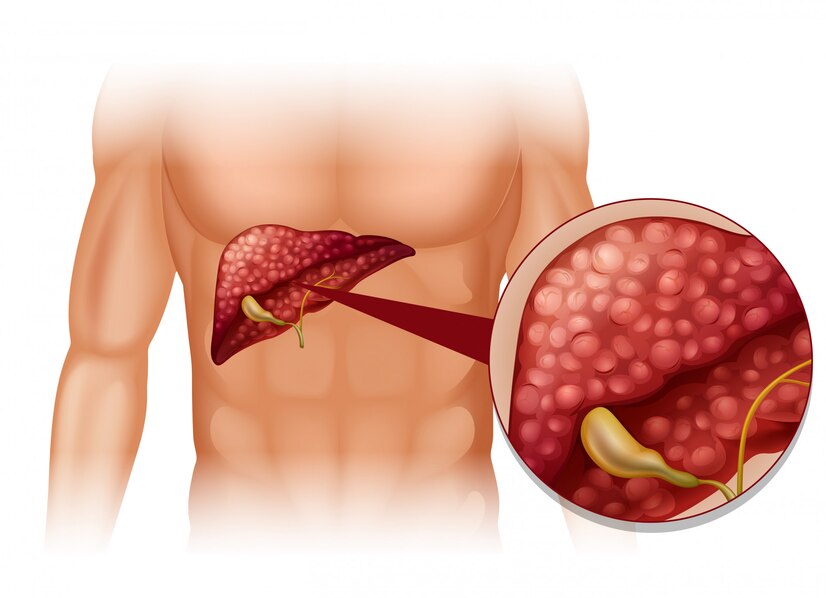 liver transplant treatment in india